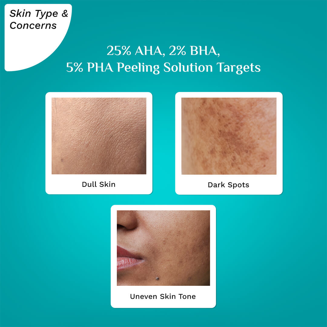 25% AHA, 2% BHA, 5% PHA Peeling Solution